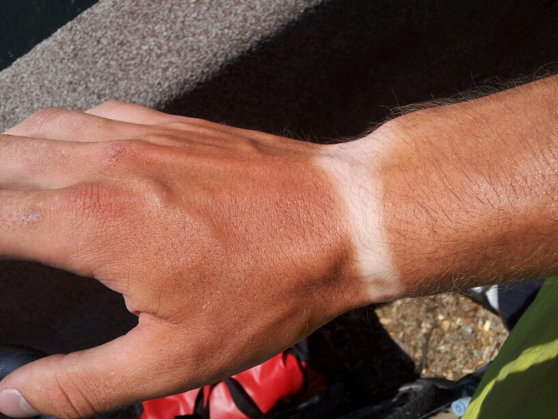 Ладони после автозагара. Загорелые женские стопы. Красивые пальцы. Ладони у смуглых. Ладони загорают.