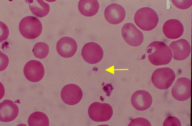Platelets%28k%29+legacy