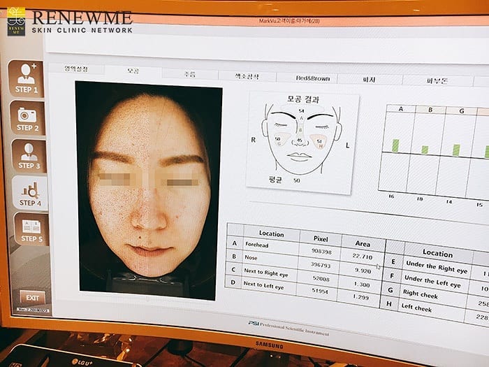 Renewme Skin Clinic Skin Analysis System from Renewme Skin Clinic