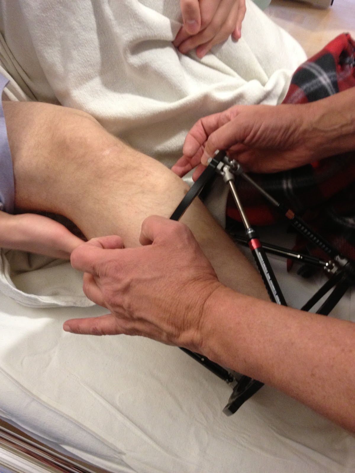 Leg+Frame: In Which I Meet the Frame