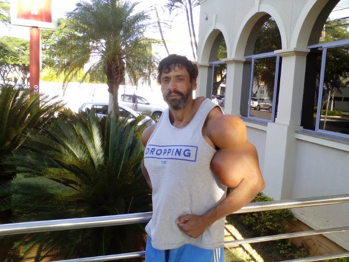 Indians alive This BodyBuilder Has Been Injecting Oil To Get 23Inch