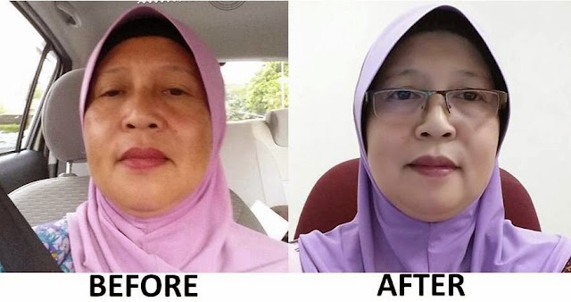 Q'SARRA BEAUTY SKINCARE, malaysian best product,malaysia skincare, qsarra beauty skincare review, qsarra beauty skincare kkm,