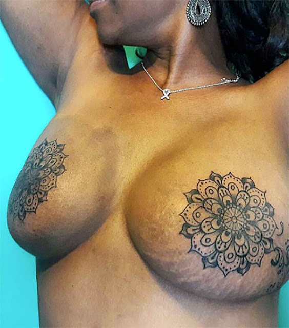LOOK: Tattoo Artists Create A Masterpiece By Covering Up These Huge Scars With A Stunning Tattoo! LOOK: Tattoo Artists Create A Masterpiece By Covering Up These Huge Scars With A Stunning Tattoo!