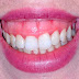 ESTÉTICA : ¿Cómo tratar la sonrisa gingival?