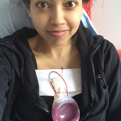 Everything you need to know about surgical drains