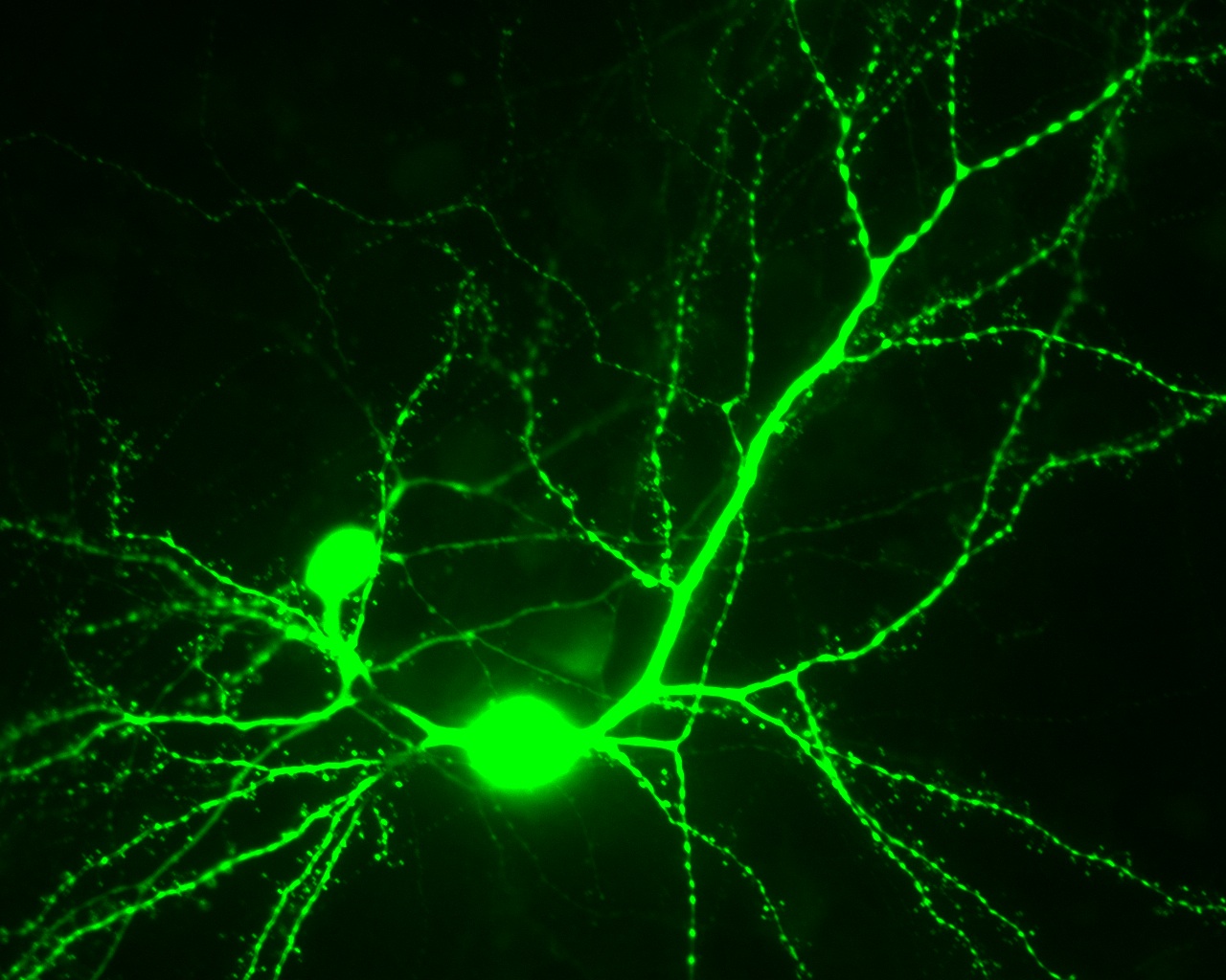 Brain effect. Нейроны. Нейроны мозга. Зеленые Нейроны. Нейрон красивый.