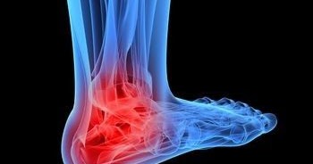heel spur treatment in ayurveda