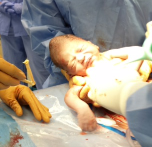 Birth Detective: Why Didn’t My OP Baby Come Down? Part 2 of 3 Spinning Babies Would a forward leaning inversion through 3 contractions have helped reduce pain once the technique was over?