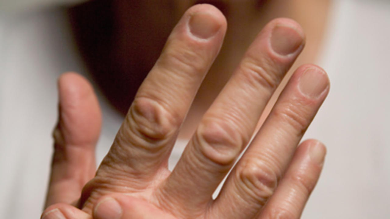 кожа на суставах пальцев