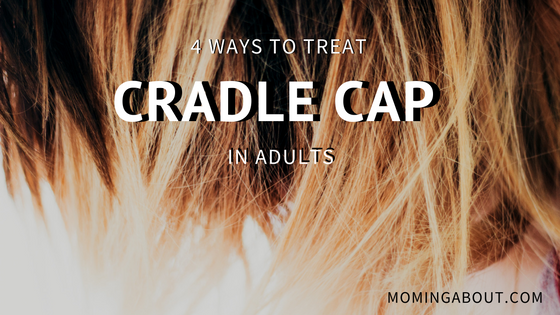 Cradle Cap Adult 3