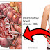 10 Early But Dangerous Signs Of ULCER You Shouldn't Ignore