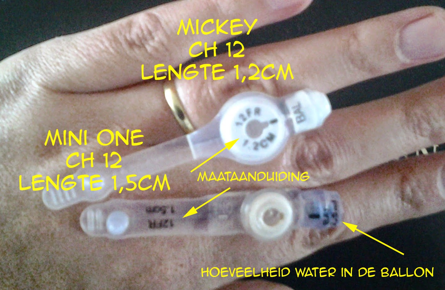 The perks of having a special needs family AMT Mini One vs. KimberleyClark MicKey