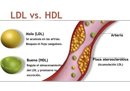 Examen de Colesterol