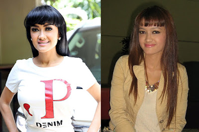 artis oplas sebelum dan sesudah artis operasi plastik sebelum dan sesudah artis operasi plastik seperti barbie artis operasi plastik sukses artis sm oplas Jupe