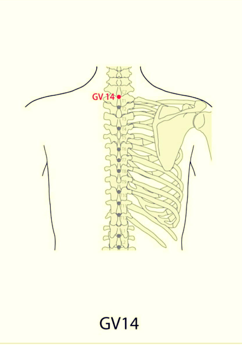 SaroEpic Acupuncture Acupuncture points for dry cough