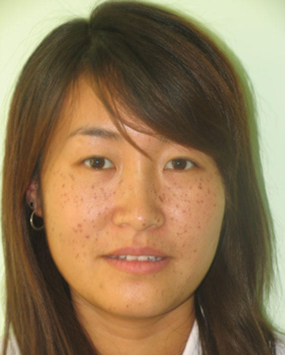 Asian girls with freckles Femdom spanking video tube free