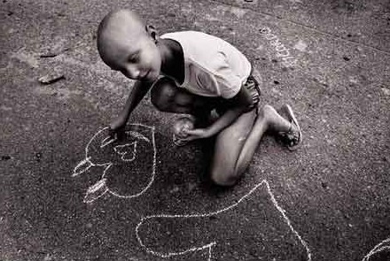 Deformutilation: Chernobyl victims