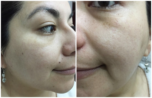 [Skin&Lab] Dr. Bio Infusion Bio Activating Essence | Korean Beauty Dream