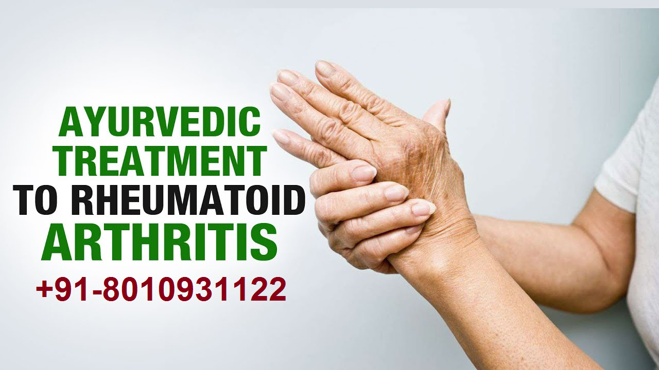 +918010931122best Rheumatoid Arthritis Treatment In MG Road Gurgaon