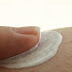 Dry Skin Rash Treatment For Skin Care