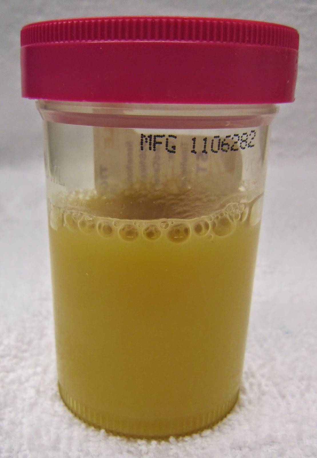 Wellness Lab Health Info: What Does The Colour Of Your Urine Says About ...
