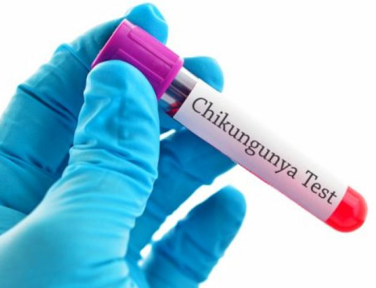 Chikungunya Mein Koun Sa Test Krayen