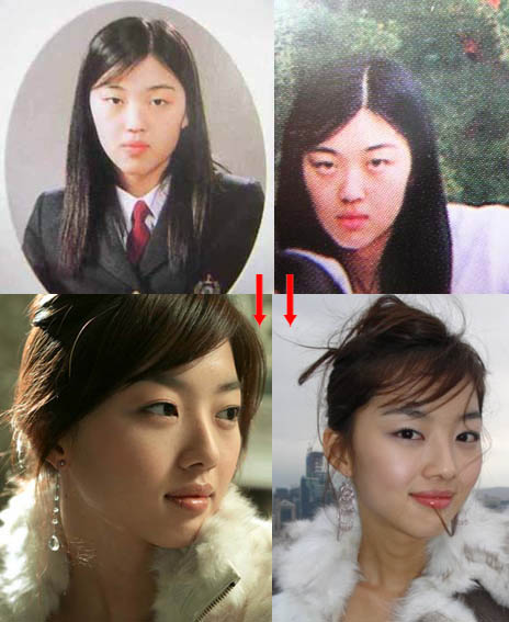  foto artis korea sebelum dan sesudah operasi plastik 