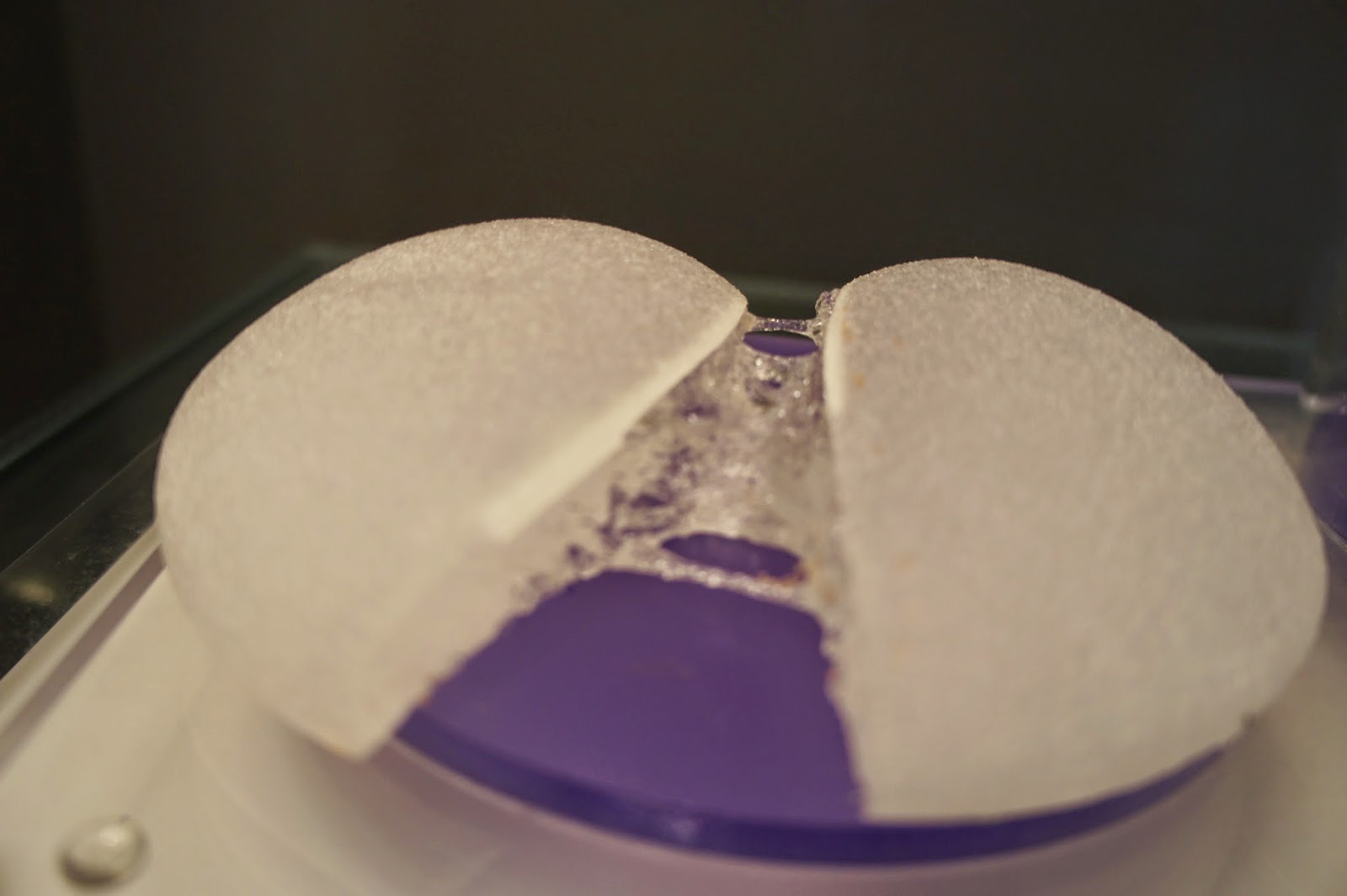 Dr. Lee Breast augmentation Korea: Do breast implants need to be