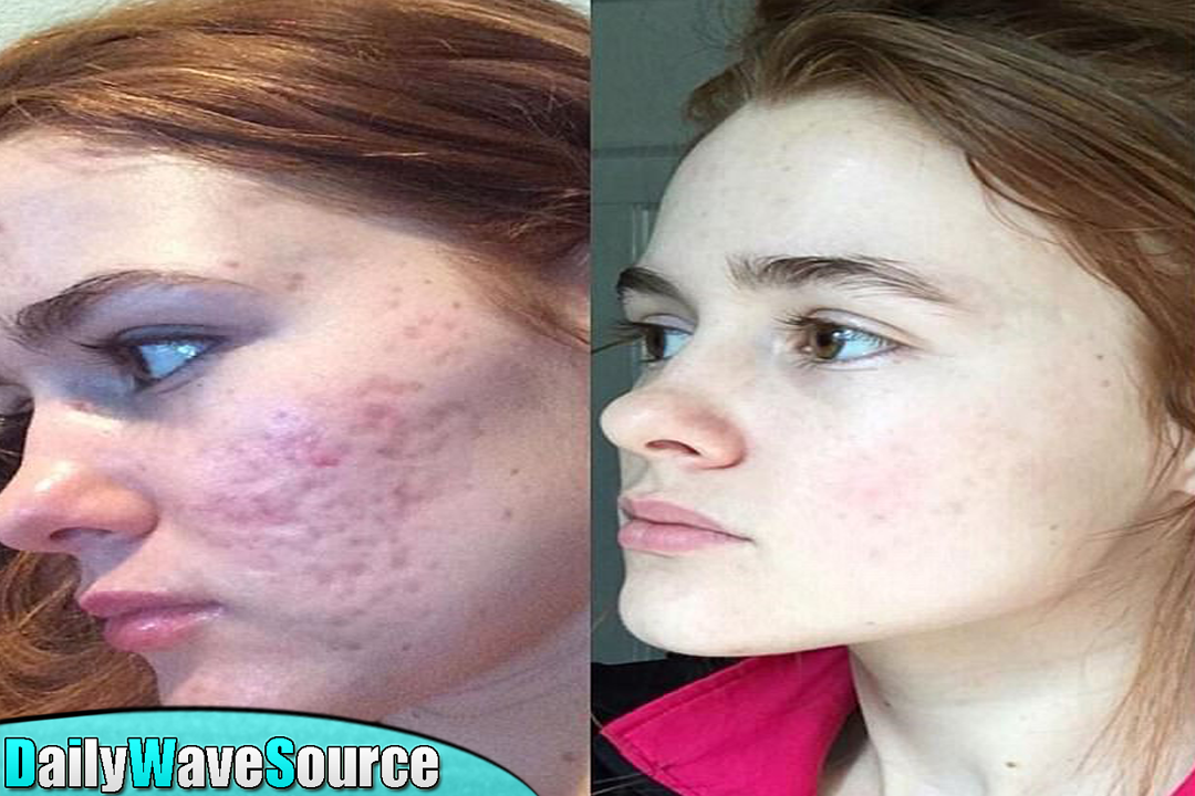 This is what happens to your body when you stop eating sugar