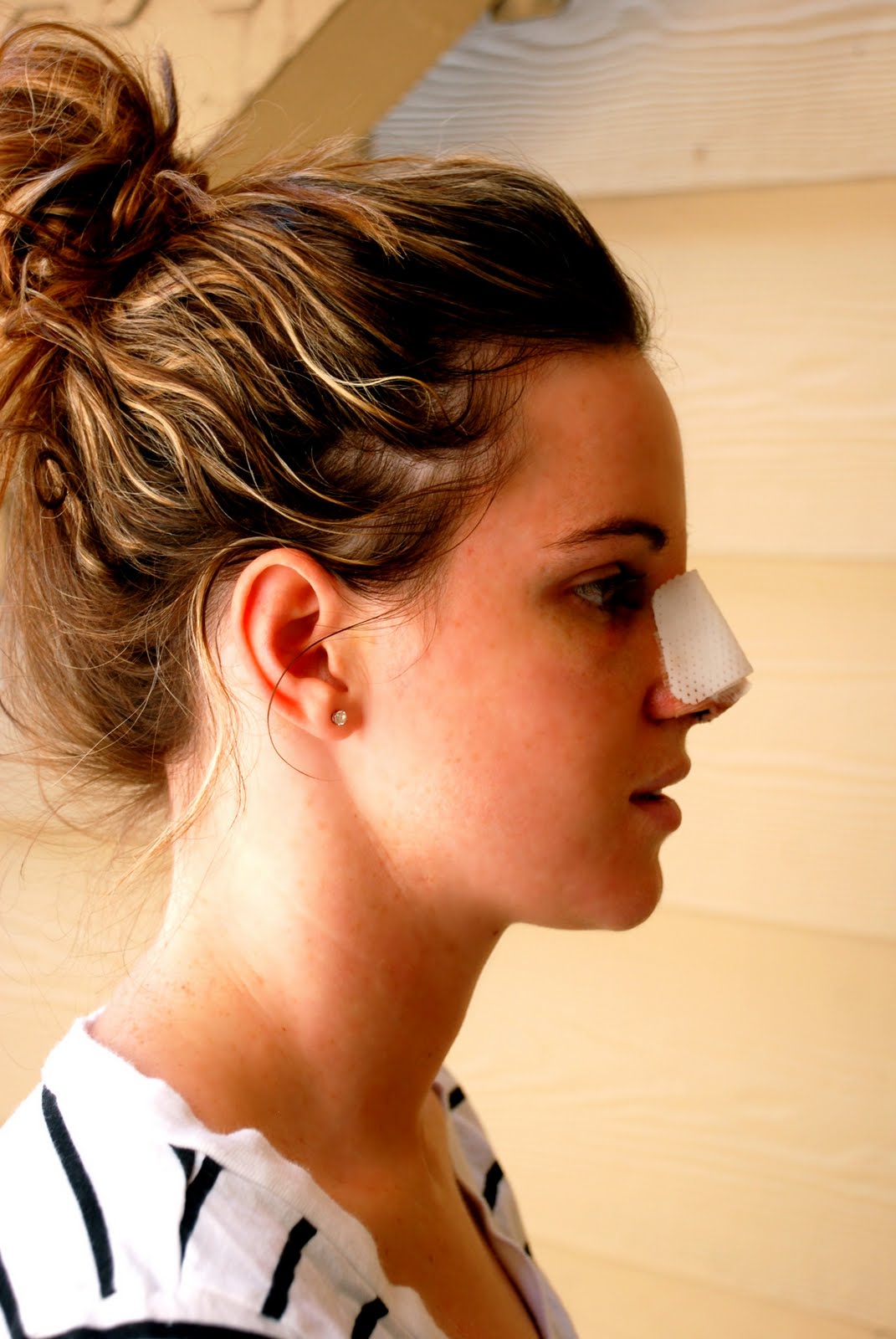 The BIG NOSE Job Day 3