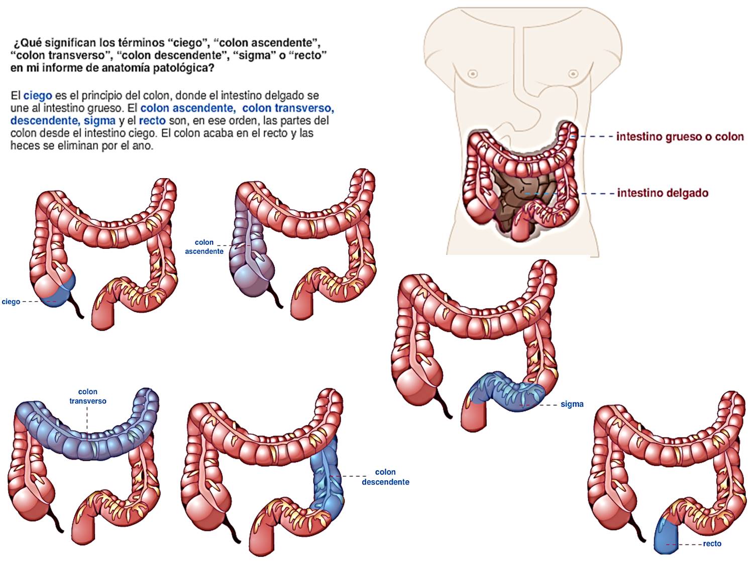 COLITIS, COMO SE DIVIDE EL COLON, PARA QUE SIRVE, EN DONDE ESTA EL