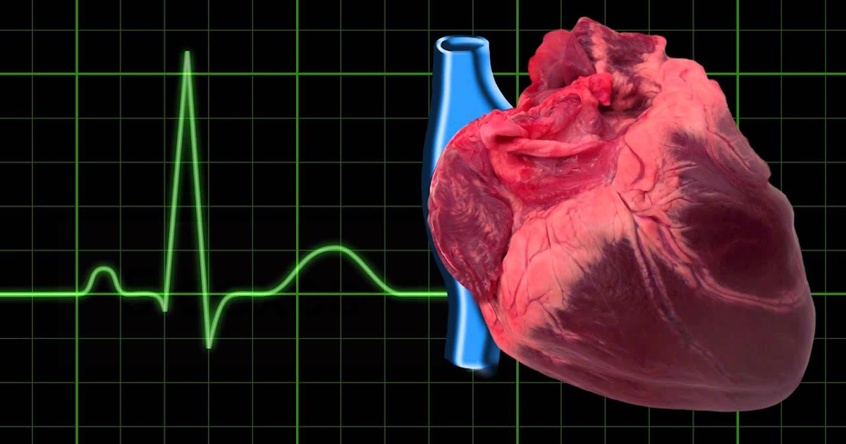 What are the signs and symptoms of a heart blockage?