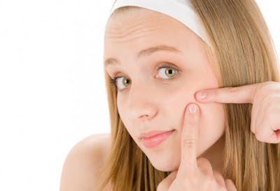 Best Acne Treatment for Teens