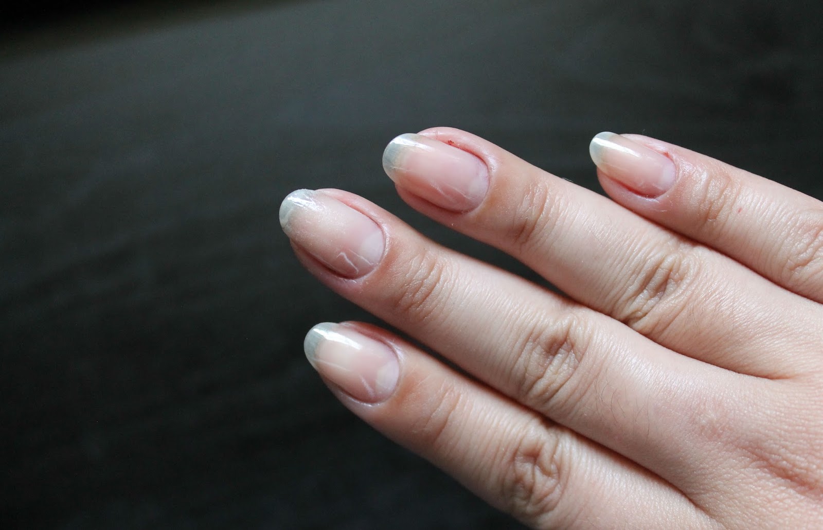 Mending a Broken Nail Tea Bag Patch