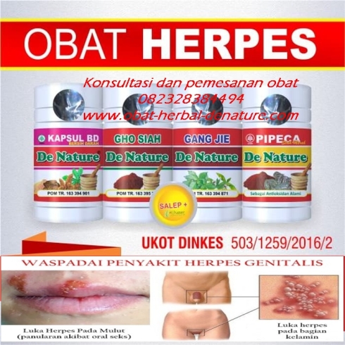 obat herpes kelamin, herpes kemaluan, herpes zoster, herpes kulit