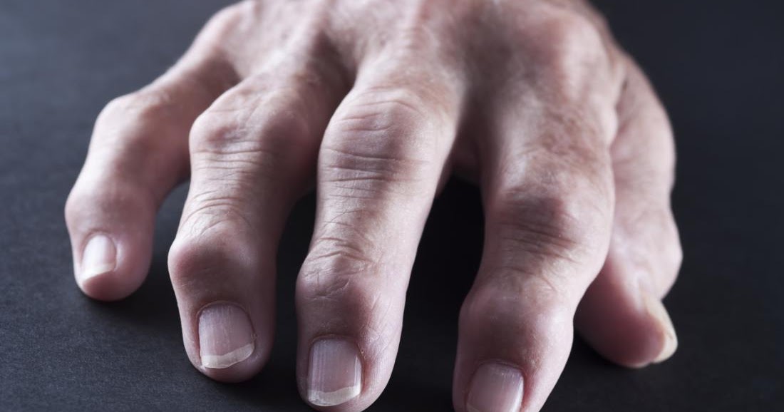 chercher ici Dureté du col du cygne Causes et traitement