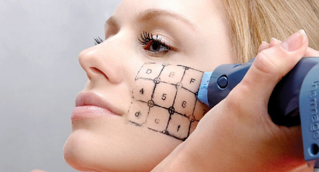 treatments like Thermage for skin lifting 