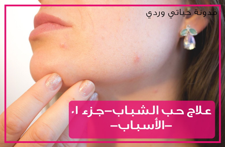 حياتي وردي كيفية التخلص من حب الشباب علاقة الطعام واسلوب الحياه بحدوثه 01