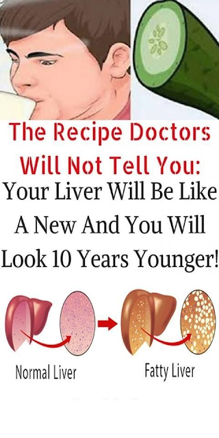 THE RECIPE DOCTORS WILL NOT TELL YOU YOUR LIVER WILL BE LIKE A NEW AND YOU WILL LOOK 10 YEARS YOUNGER!