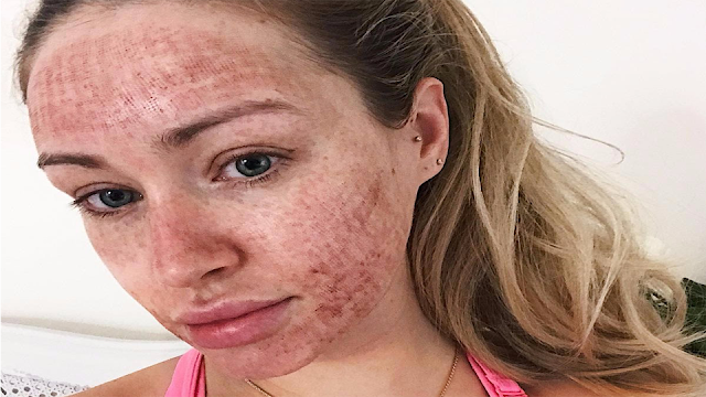 فوائد كريم سيكاتوب واستخداماته