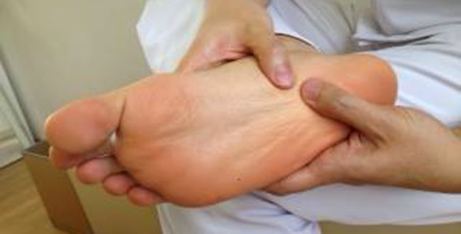 足底筋膜炎 輔具幫忙釋壓