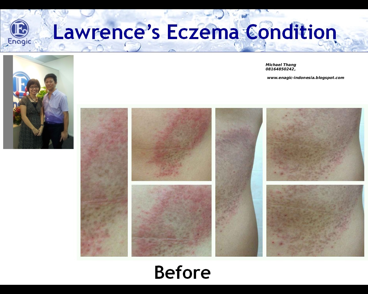 Kangen Alkaline Ionized Water TESTIMONY