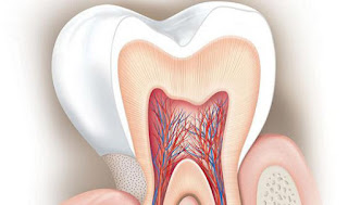 causes des dents sensibles après le remplissage