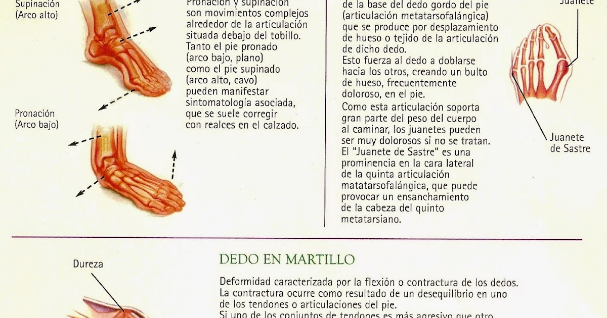 Se rasca el pie el hongo la medicina
