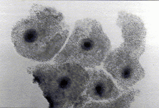 Número óptimo ovocitos recuperados tras punción ovárica