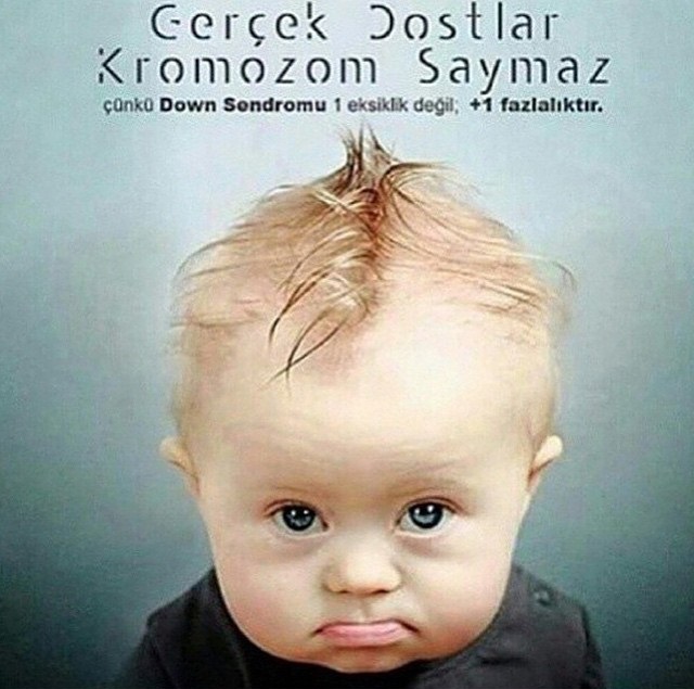 Down Sendromu Farkındalık Günü Her Şeyden Konuşmalı