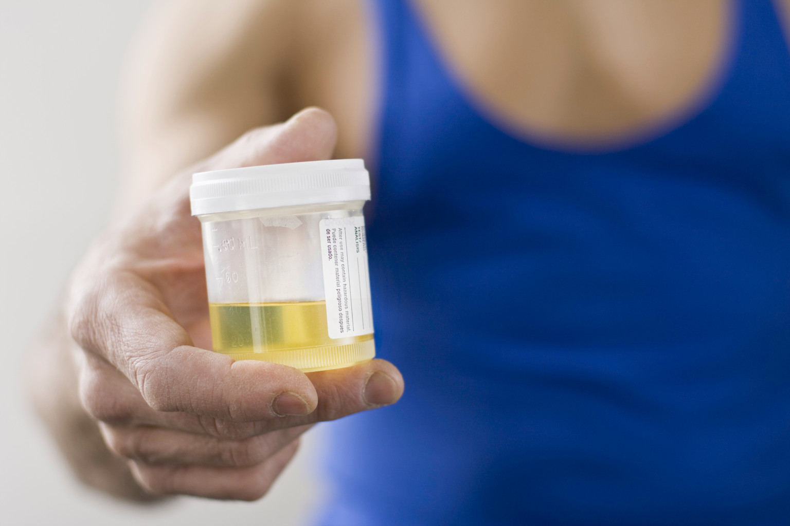 pee color says about health