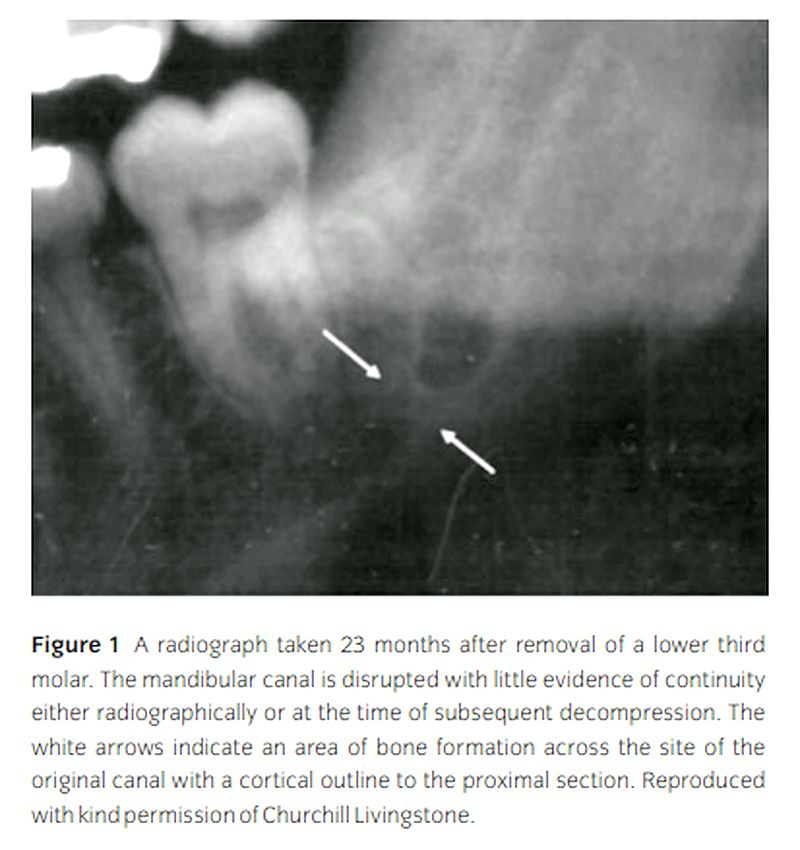 PDF A prospective, quantitative study on the clinical of