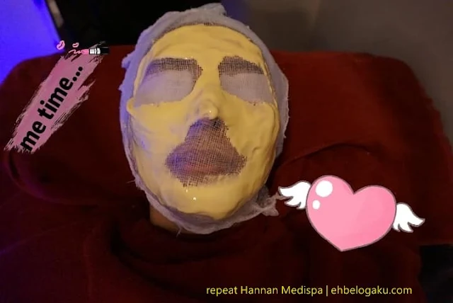 buang jeragat,cara buang pigmenatasi kulit,beauty blogger