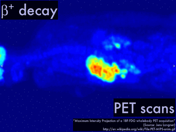 If you ever have a PET scan, think not just about drinking radioactive sugar water, but about antimatter and matter annihilating in your body! If you ever have a PET scan, think not just about drinking radioactive sugar water, but about antimatter and matter annihilating in your body!
